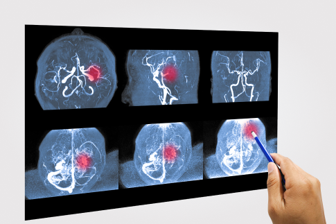 Specialty Image
